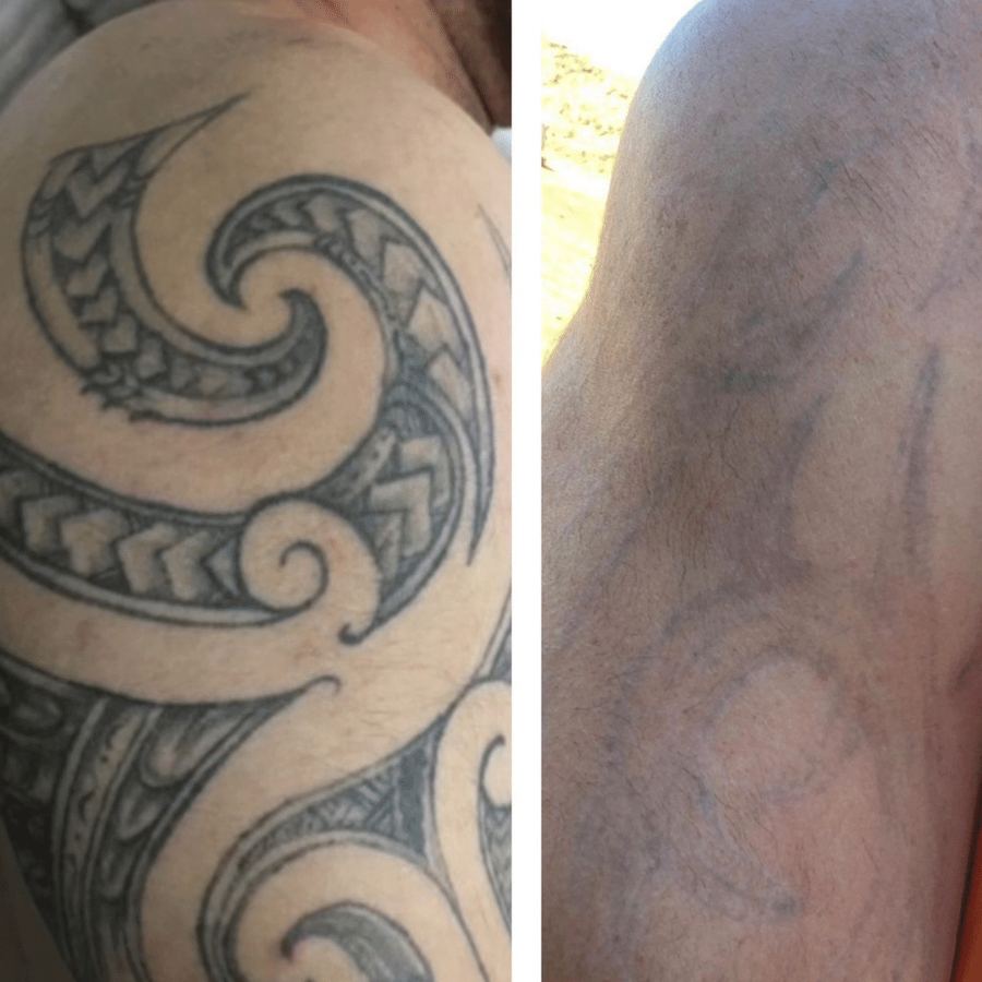 After 7 sessions