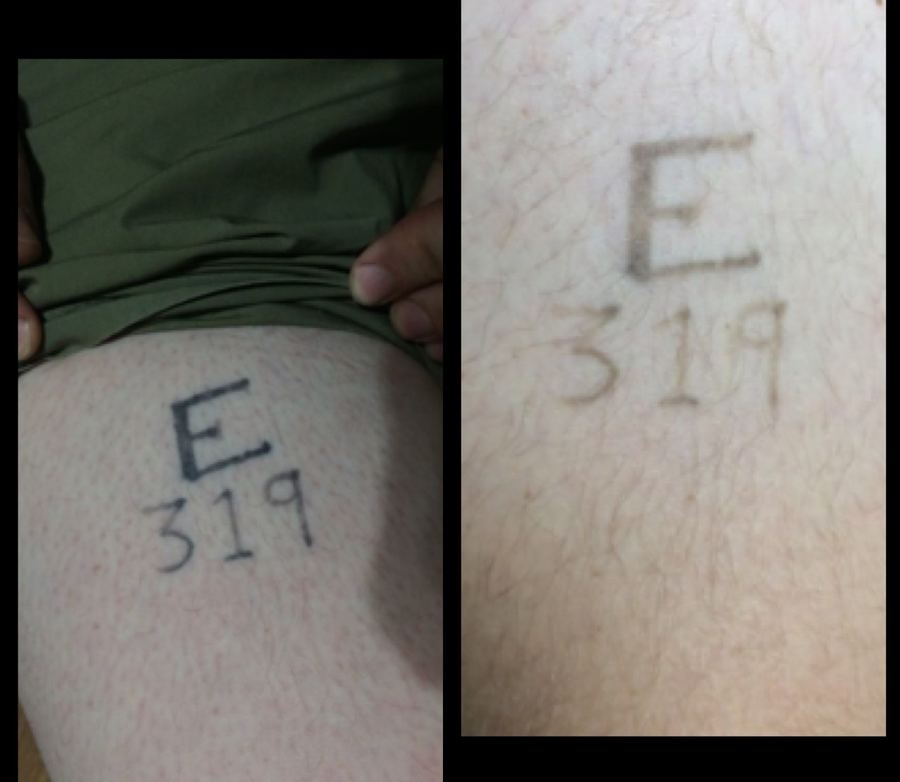 Black tattoo — before & after