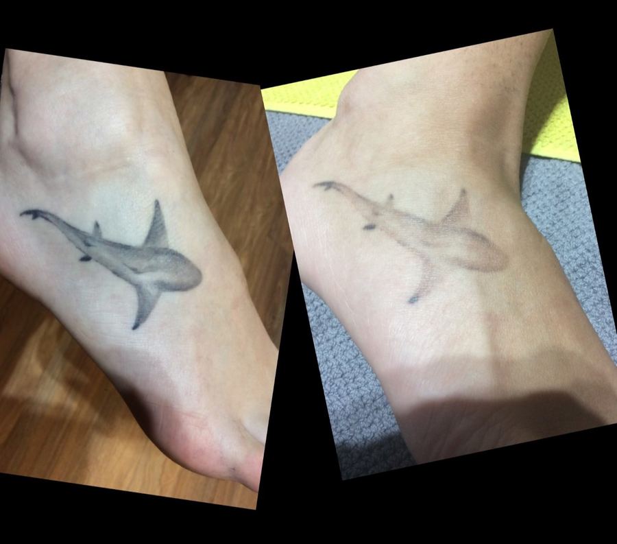 Sleeve section — before & after