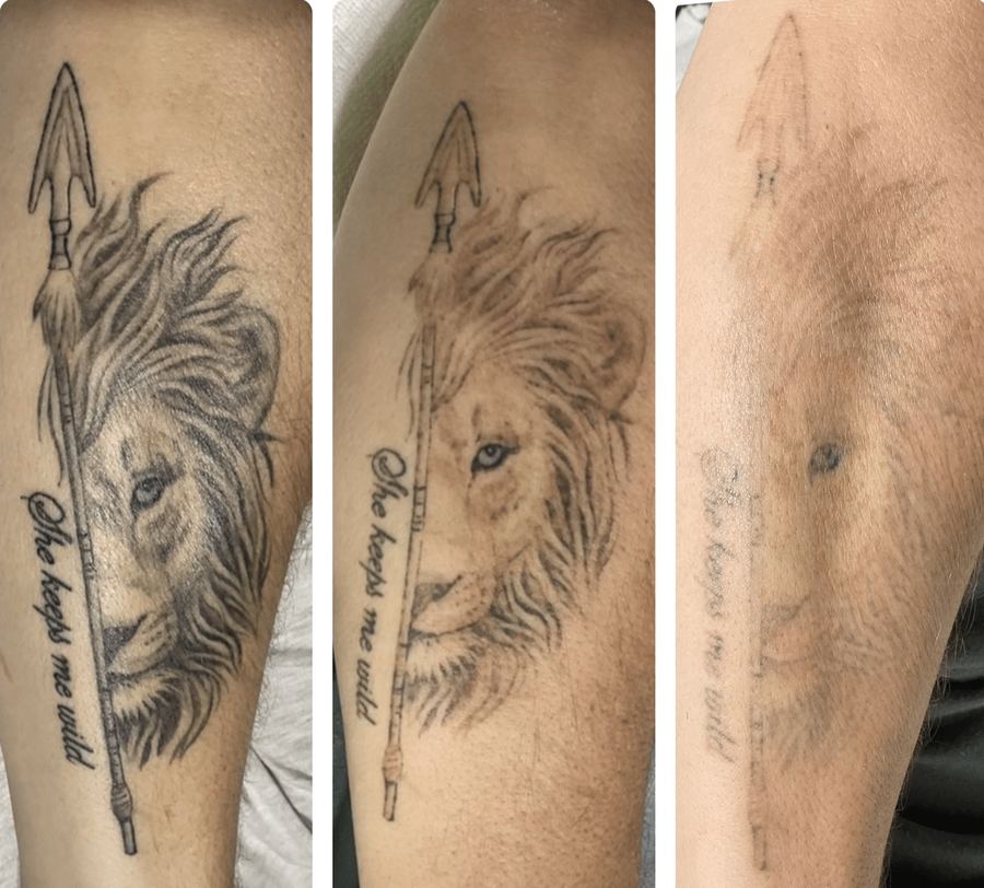 Leg tattoo — before & after
