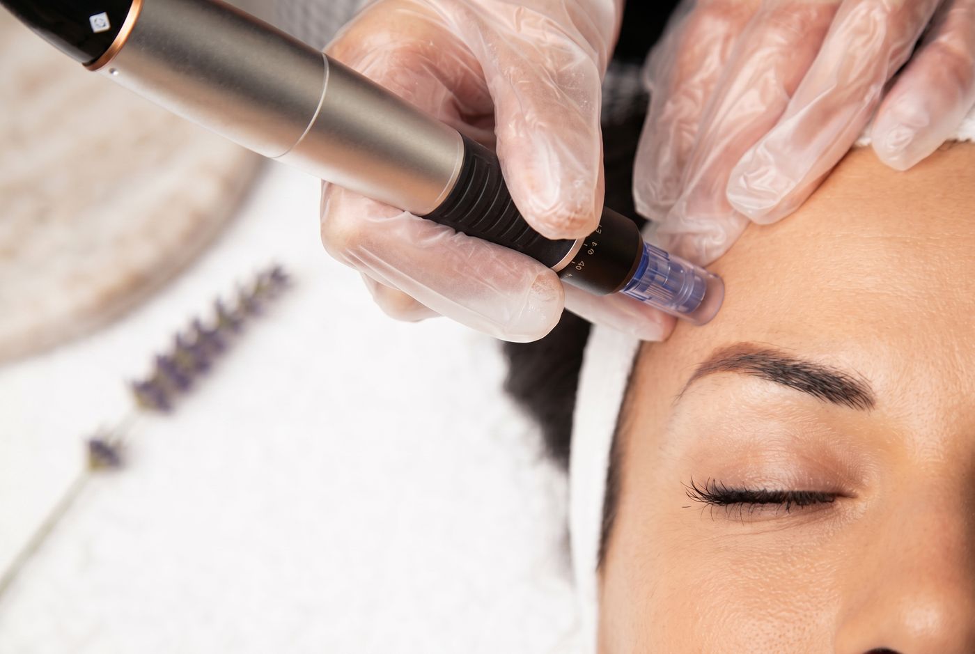Skin rejuvenation